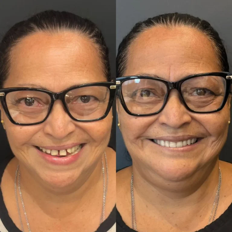 Resultado de tratamento odontológico realizado na Exclusive Odontologia (6)